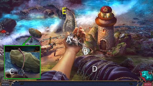 Bridge to Another World: Gulliver Syndrome